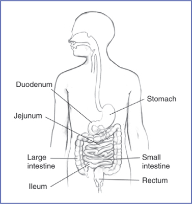 Short bowel Syndrome – Kids Tummies Website